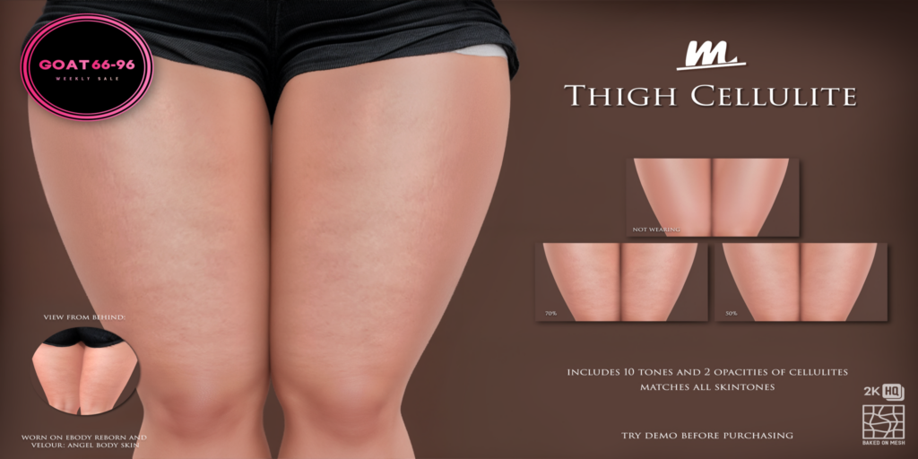 Thigh Cellulite - BOM